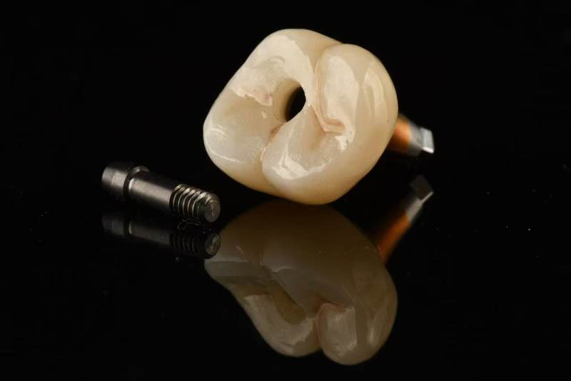 Single dental crown of implant